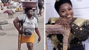 Amputee Hawker Shares Amazing Transformation Photo As She Celebrates Her 27th Birthday