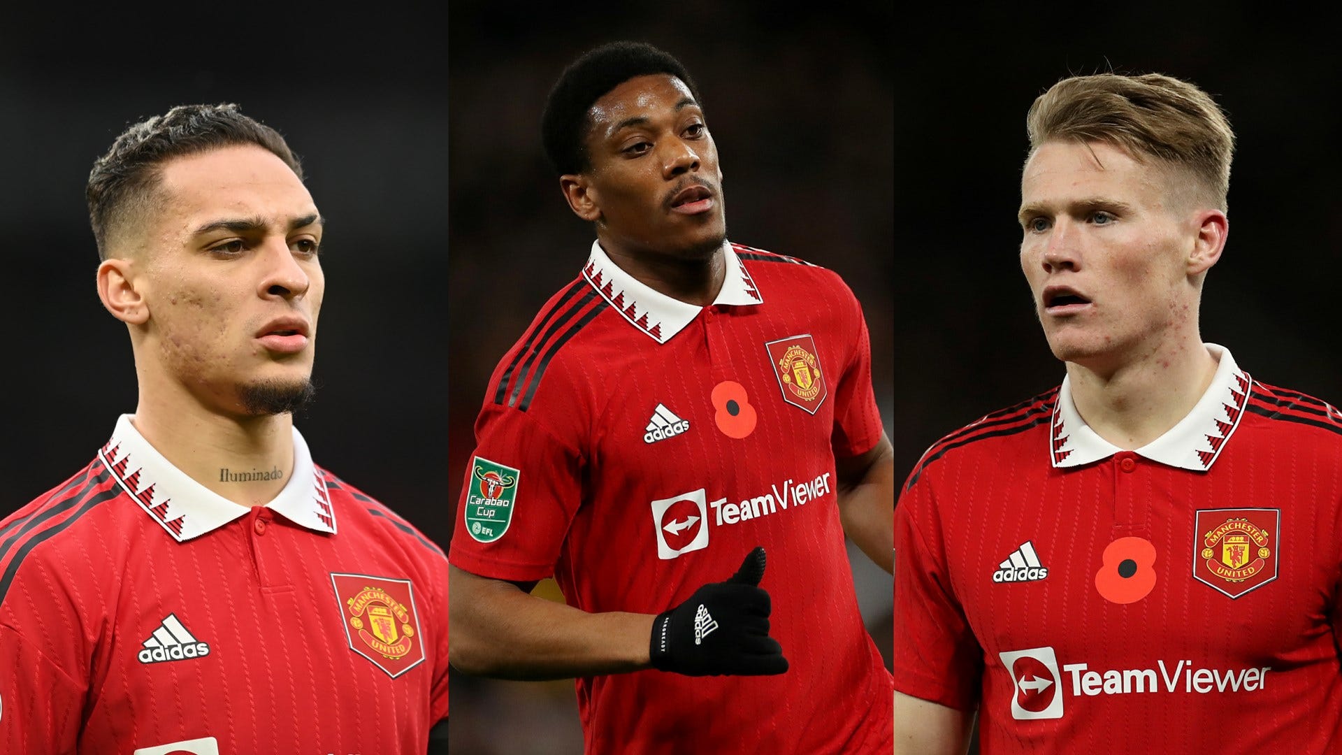 Manchester United Suffers Triple Injury Blow Ahead of Leeds Clash On Sunday
